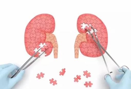 Η «σιωπή των νεφρών» πλήττει ένα εκατομμύριο Έλληνες