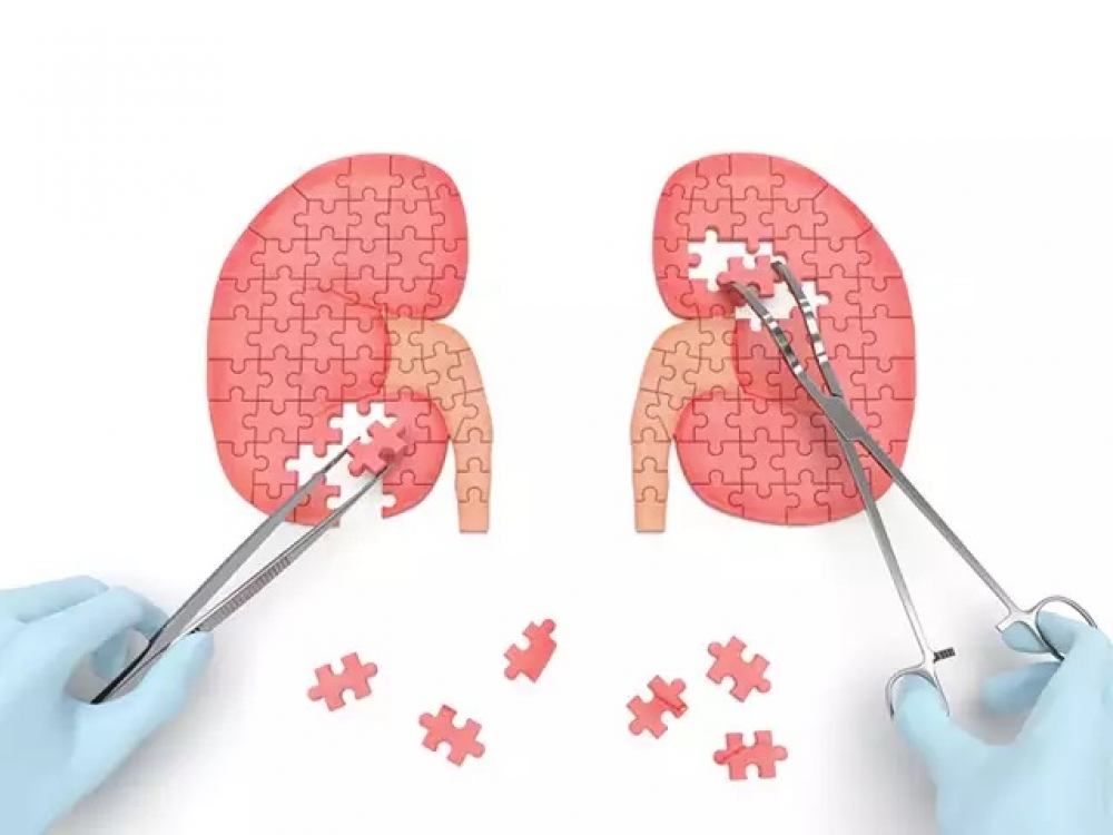 &Eta; &laquo;&sigma;&iota;&omega;&pi;ή &tau;&omega;&nu; &nu;&epsilon;&phi;&rho;ώ&nu;&raquo; &pi;&lambda;ή&tau;&tau;&epsilon;&iota; έ&nu;&alpha; &epsilon;&kappa;&alpha;&tau;&omicron;&mu;&mu;ύ&rho;&iota;&omicron; Έ&lambda;&lambda;&eta;&nu;&epsilon;&sigmaf;