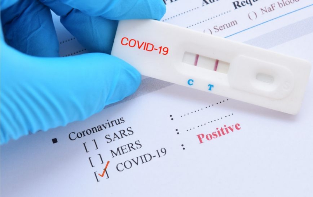 Covid-19: &Gamma;&iota;&alpha;&tau;ί &alpha;&upsilon;&xi;ή&theta;&eta;&kappa;&alpha;&nu; &xi;&alpha;&nu;ά &tau;&alpha; &kappa;&rho;&omicron;ύ&sigma;&mu;&alpha;&tau;&alpha; &kappa;&omicron;&rho;&omega;&nu;&omicron;ϊ&omicron;ύ;