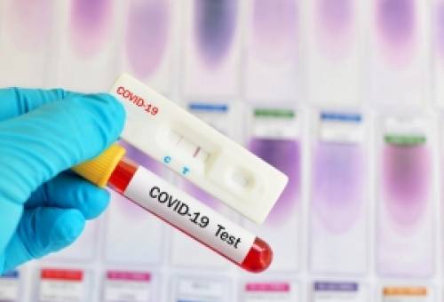 Κορωνοϊός: 3 θετικά κρούσματα στο Λευκόχωμα Σπάρτης