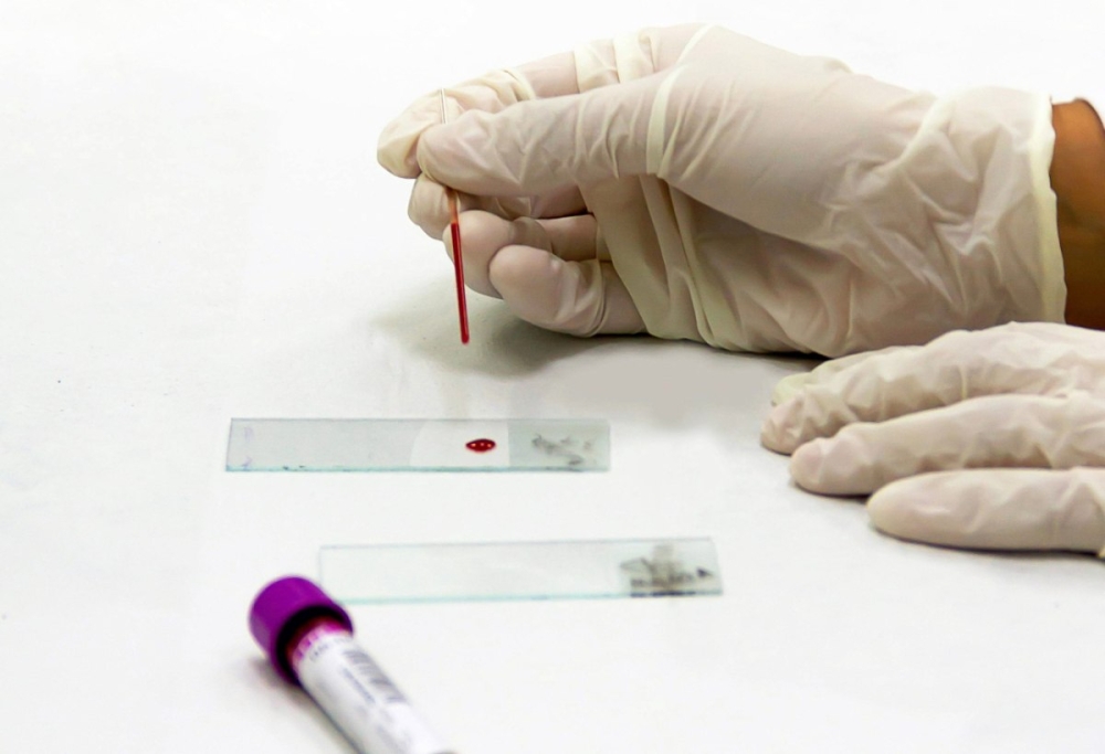 &Tau;&epsilon;&sigma;&tau; &alpha;ί&mu;&alpha;&tau;&omicron;&sigmaf; &alpha;&nu;&iota;&chi;&nu;&epsilon;ύ&epsilon;&iota; &tau;&eta; &nu;ό&sigma;&omicron; &tau;&omicron;&upsilon; Crohn &chi;&rho;ό&nu;&iota;&alpha; &pi;&rho;&iota;&nu; &alpha;&pi;ό &tau;&eta;&nu; &epsilon;&mu;&phi;ά&nu;&iota;&sigma;&eta; &sigma;&upsilon;&mu;&pi;&tau;&omega;&mu;ά&tau;&omega;&nu;