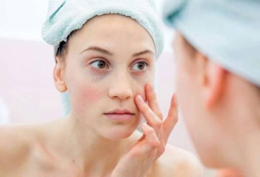 5 tips για να αντιμετωπίσεις τους μαύρους κύκλους