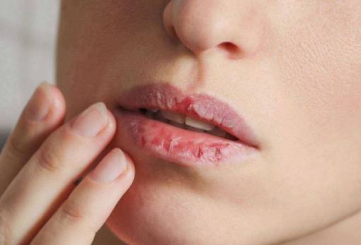 5 tips για να έχεις απαλά και όμορφα χείλη