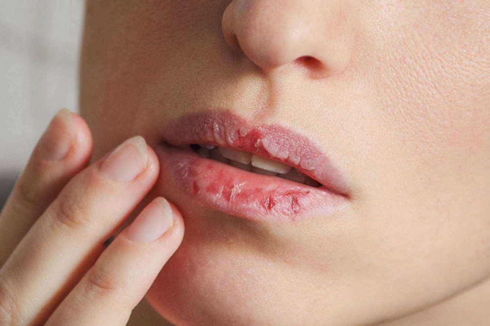 5 tips &gamma;&iota;&alpha; &nu;&alpha; έ&chi;&epsilon;&iota;&sigmaf; &alpha;&pi;&alpha;&lambda;ά &kappa;&alpha;&iota; ό&mu;&omicron;&rho;&phi;&alpha; &chi;&epsilon;ί&lambda;&eta;