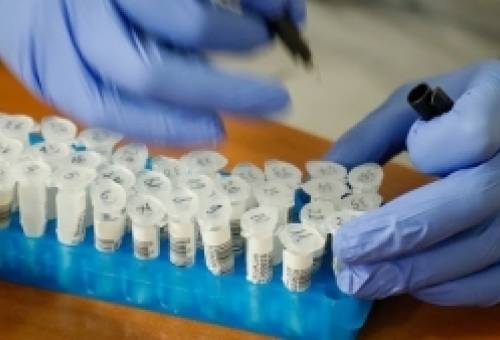 Αύξηση κρουσμάτων κορωνοϊού αναμένει η Περιφέρεια Πελοποννήσου