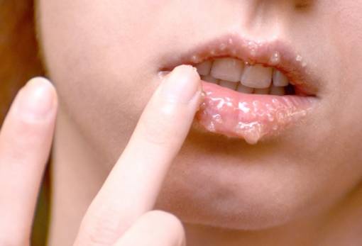 Φτιάξε μόνη σου ένα lip scrub που θα σου χαρίσει τα πιο ζουμερά & απαλά χείλη που είχες ποτέ