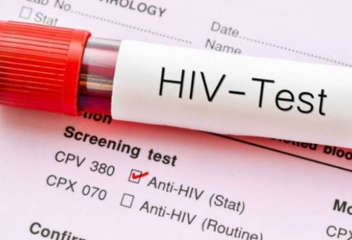Ανακαλύφθηκε στην Ευρώπη μία νέα, πιο παθογόνα και μεταδοτική, παραλλαγή του ιού HIV