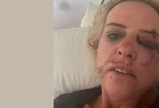 Αδέσποτοι φίλοι και κίνδυνοι…