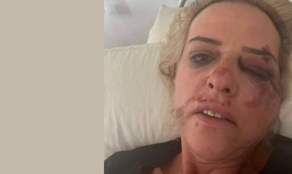 &Alpha;&delta;έ&sigma;&pi;&omicron;&tau;&omicron;&iota; &phi;ί&lambda;&omicron;&iota; &kappa;&alpha;&iota; &kappa;ί&nu;&delta;&upsilon;&nu;&omicron;&iota;&hellip;