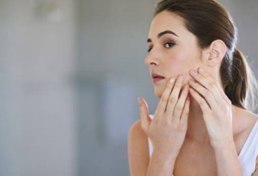 4 τοπικές θεραπείες για να αντιμετωπίσεις την ακμή