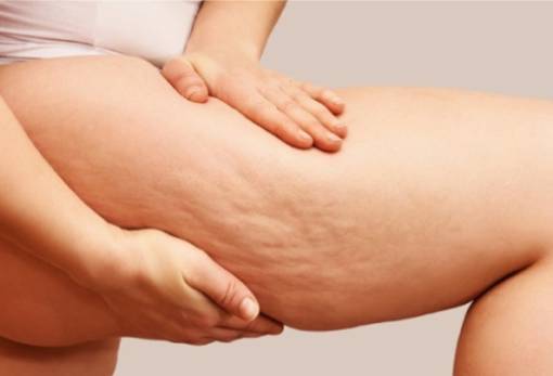 Η μάσκα που θα σε απαλλάξει από την κυτταρίτιδα πριν βγεις στην παραλία