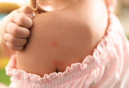 Σταφυλόκοκκος: Επικίνδυνος για παιδιά και ευπαθείς ομάδες