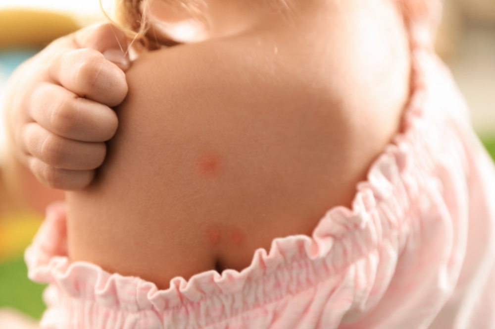 &Sigma;&tau;&alpha;&phi;&upsilon;&lambda;ό&kappa;&omicron;&kappa;&kappa;&omicron;&sigmaf;: &Epsilon;&pi;&iota;&kappa;ί&nu;&delta;&upsilon;&nu;&omicron;&sigmaf; &gamma;&iota;&alpha; &pi;&alpha;&iota;&delta;&iota;ά &kappa;&alpha;&iota; &epsilon;&upsilon;&pi;&alpha;&theta;&epsilon;ί&sigmaf; &omicron;&mu;ά&delta;&epsilon;&sigmaf;