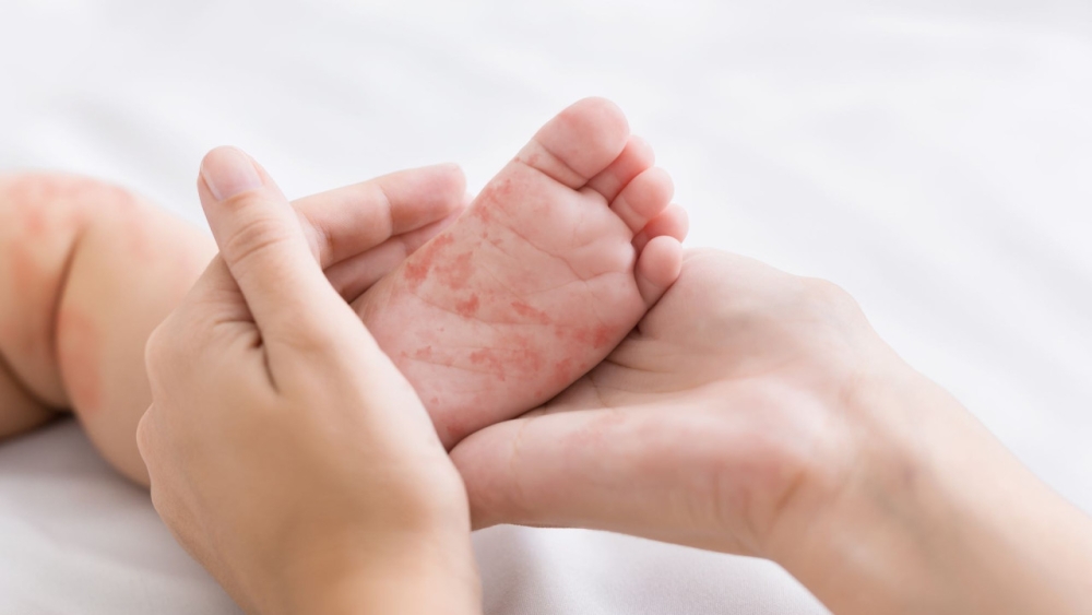 &Sigma;&upsilon;&nu;&alpha;&gamma;&epsilon;&rho;&mu;ό&sigmaf; &gamma;&iota;&alpha; &tau;&eta;&nu; &pi;&iota;&theta;&alpha;&nu;ή &alpha;&nu;&tau;&iota;&mu;&epsilon;&tau;ώ&pi;&iota;&sigma;&eta; &epsilon;&pi;&iota;&delta;&eta;&mu;ί&alpha;&sigmaf; &iota;&lambda;&alpha;&rho;ά