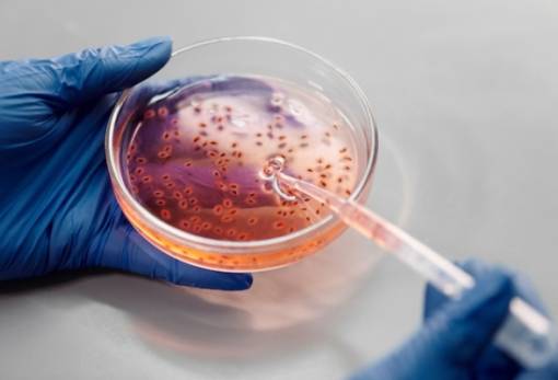 Προειδοποίηση για θανατηφόρο ανθεκτικό βακτήριο που εξαπλώνεται στην Ευρώπη