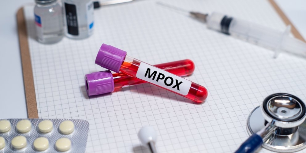 &Iota;ό&sigmaf; mpox: &Epsilon;&pi;&epsilon;ί&gamma;&omicron;&upsilon;&sigma;&alpha; &sigma;ύ&gamma;&kappa;&lambda;&eta;&sigma;&eta; &tau;&omicron;&upsilon; &Pi;&alpha;&gamma;&kappa;ό&sigma;&mu;&iota;&omicron;&upsilon; &Omicron;&rho;&gamma;&alpha;&nu;&iota;&sigma;&mu;&omicron;ύ &Upsilon;&gamma;&epsilon;ί&alpha;&sigmaf;