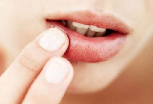 Tips για υπέροχα και ενυδατωμένα χείλη