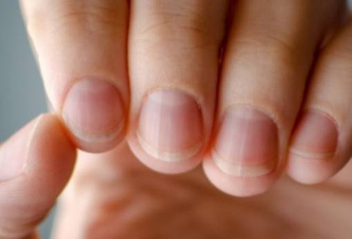 Κίτρινα νύχια μετά από ακρυλικό μανικιούρ;