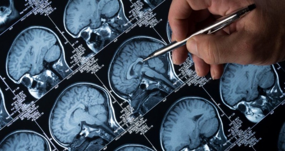 &Pi;&omicron;&iota;&epsilon;&sigmaf; &omicron;&delta;&eta;&gamma;&iota;&kappa;έ&sigmaf; &sigma;&upsilon;&nu;ή&theta;&epsilon;&iota;&epsilon;&sigmaf; &mu;&pi;&omicron;&rho;&omicron;ύ&nu; &nu;&alpha; &alpha;&pi;&omicron;&kappa;&alpha;&lambda;ύ&psi;&omicron;&upsilon;&nu; &pi;&rho;ώ&iota;&mu;&alpha; &sigma;&upsilon;&mu;&pi;&tau;ώ&mu;&alpha;&tau;&alpha; &tau;&eta;&sigmaf; &nu;ό&sigma;&omicron;&upsilon; &Alpha;&lambda;&tau;&sigma;&chi;ά&iota;&mu;&epsilon;&rho;