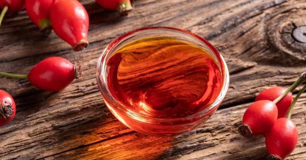 Έ&lambda;&alpha;&iota;&omicron; ά&gamma;&rho;&iota;&omicron;&upsilon; &tau;&rho;&iota;&alpha;&nu;&tau;ά&phi;&upsilon;&lambda;&lambda;&omicron;&upsilon;: 3 &omicron;&phi;έ&lambda;&eta; &tau;&omicron;&upsilon; &sigma;&tau;&alpha; &mu;&alpha;&lambda;&lambda;&iota;ά &kappa;&alpha;&iota; &tau;&omicron; &tau;&rho;&iota;&chi;&omega;&tau;ό &tau;&eta;&sigmaf; &kappa;&epsilon;&phi;&alpha;&lambda;ή&sigmaf;